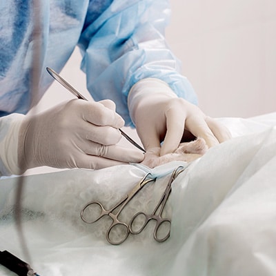 standard excision procedure