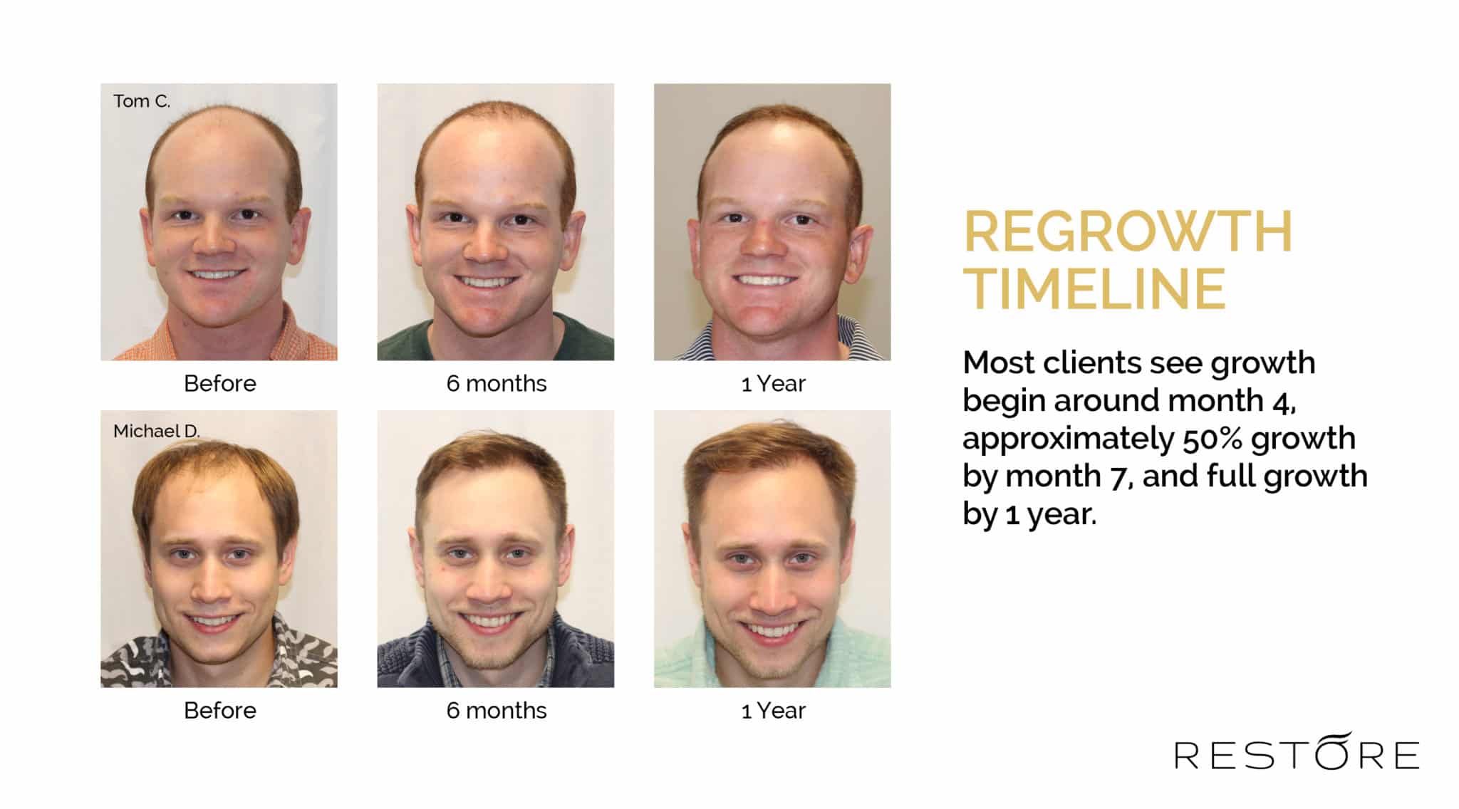 Regrowth Timeline - Most clients see growth begin around month 4, approximately 50% growth by month 7, and full growth by 1 year.