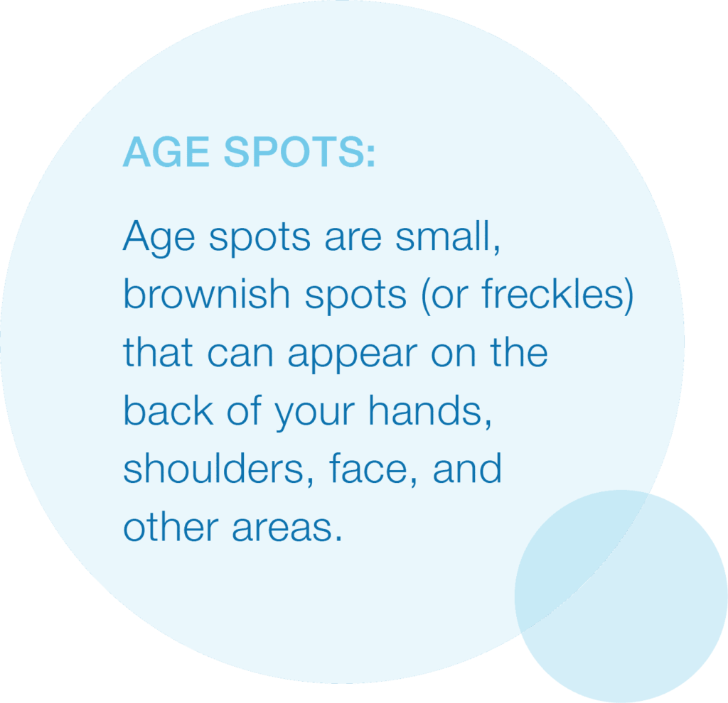 Graphic listing definition of age spots