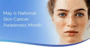 Headshot of May is National Skin Cancer Month