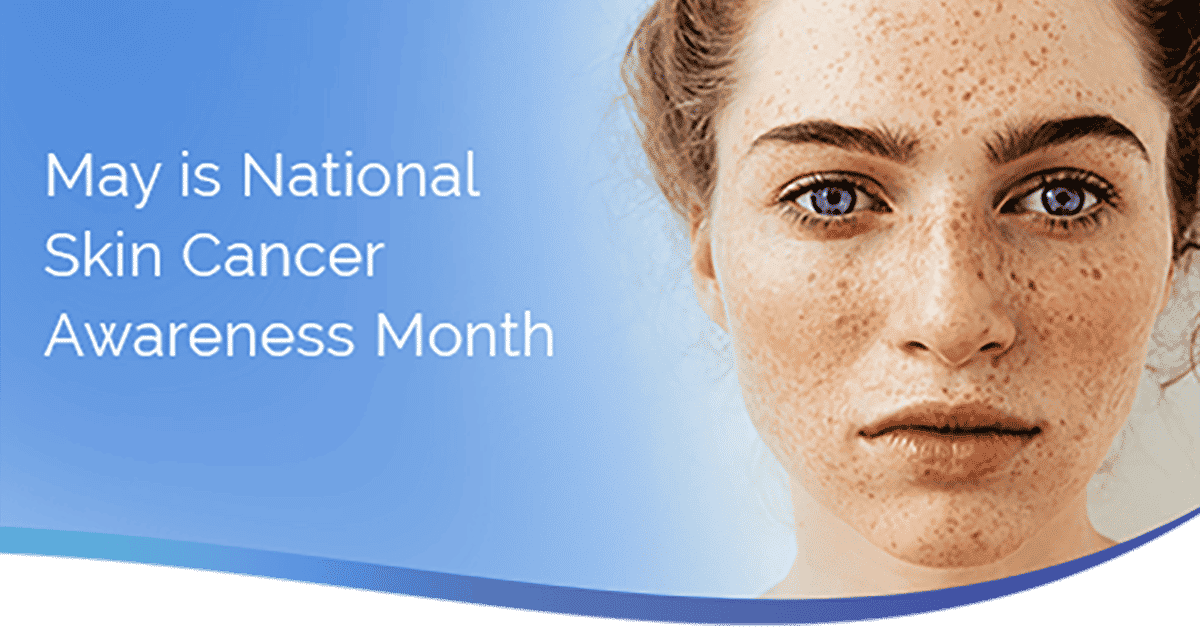 Headshot of May is National Skin Cancer Month