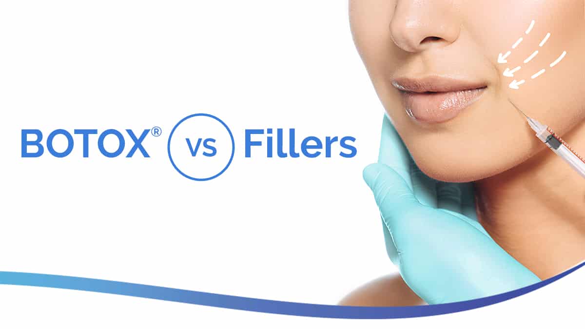 Headshot of BOTOX vs. fillers: how to choose?