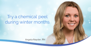 Headshot of Chemical peels for winter months