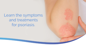 Headshot of Psoriasis Treatments and Symptoms