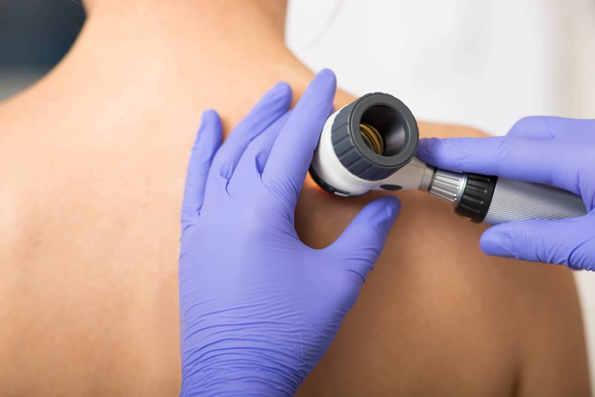 dermatologist assessing skin on patient's back