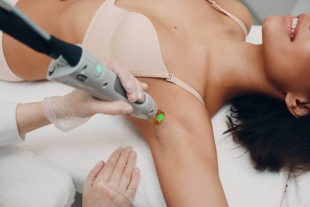 woman getting laser on her underarms